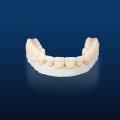 Multilayerd Full Zirconia Dental Restoration